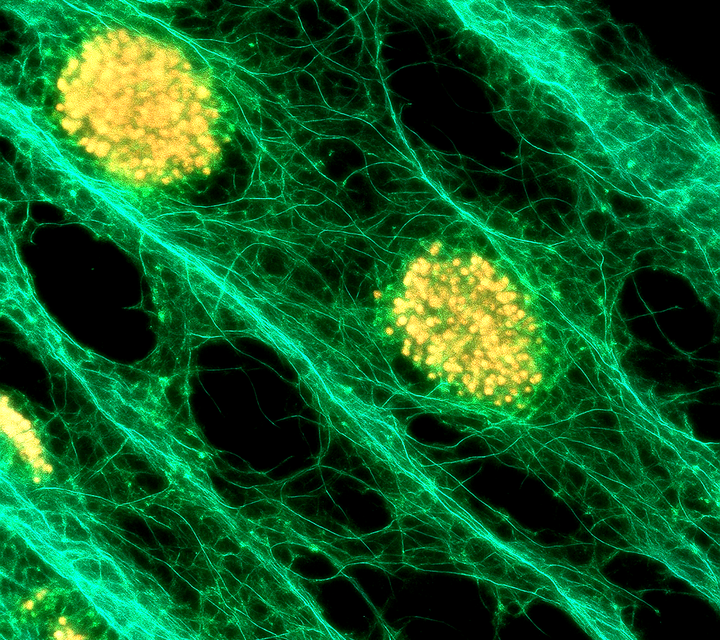 Oral Health Status as an Inflammation Barometer