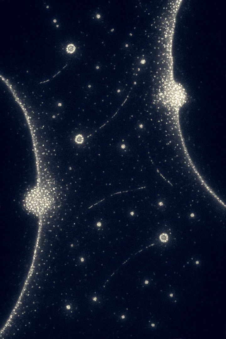 Cuando la diabetes se hace visible en la boca